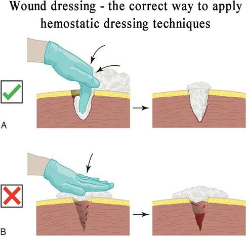 Reusable Silicone Thigh Wound Packing Trainer, Stop The Bleed Bleeding Control Simulator with Laceration Trauma Wound, First Aid Training Model for Military, Medical School and EMT Training in Kuwait