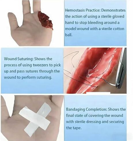 Hand Wound Packing Trainer Model, Finger Amputation Wound Hemostasis Practice Model, Reusable, Simulate Real-World Scenarios, for Teaching and Training in Kuwait