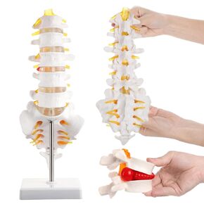 2Pcs Lumbar Spine Model Flexible Anatomical Lumbar Vertebrae with 5 Vertebrae and Herniated Disc Model Set for Medical Students, Doctors Patient Education and Chiropractic in Kuwait