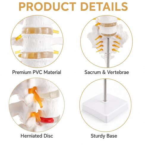 2Pcs Lumbar Spine Model Flexible Anatomical Lumbar Vertebrae with 5 Vertebrae and Herniated Disc Model Set for Medical Students, Doctors Patient Education and Chiropractic in Kuwait