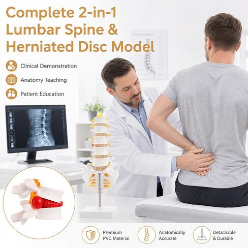 2Pcs Lumbar Spine Model Flexible Anatomical Lumbar Vertebrae with 5 Vertebrae and Herniated Disc Model Set for Medical Students, Doctors Patient Education and Chiropractic in Kuwait