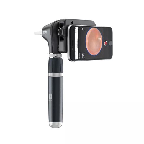 مجموعة التشخيص Welch Allyn 3.5V مع منظار الأذن MacroView Plus لـ iExaminer in Kuwait