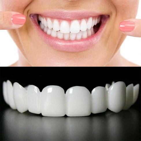 قشور Snap-On - مجموعة احترافية لتصحيح الابتسامة يمكنك صنعها بنفسك للرجال والنساء - مجموعة علوية وسفلية بيضاء مريحة وطبيعية - مثالية لإخفاء الفجوات والبقع والأسنان المفقودة - ملائمة للمنزل بسهولة in Kuwait