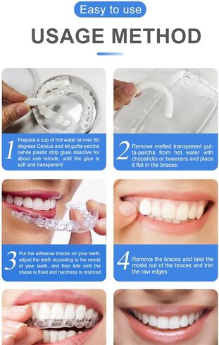 قشور Snap-On - مجموعة احترافية لتصحيح الابتسامة يمكنك صنعها بنفسك للرجال والنساء - مجموعة علوية وسفلية بيضاء مريحة وطبيعية - مثالية لإخفاء الفجوات والبقع والأسنان المفقودة - ملائمة للمنزل بسهولة in Kuwait