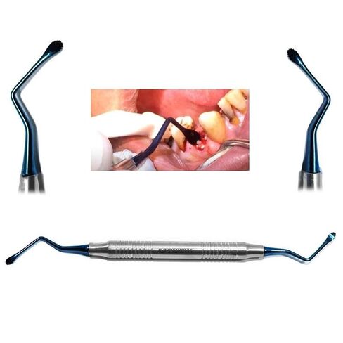 6Pcs Lucas Curettes - Dental Surgical Instruments with Serrated Blue Color Tips | Lightweight Hollow Design | for Periodontal and Implant Procedures in Kuwait