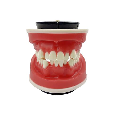 Orthodontic Teaching Model, YOUYA DENTAL Orthodontics Malocclusion Teeth Typodont Demonstration Educational Training Model Red Wax Gum Teeth Practice Model for Teaching Study (Without Orthodontic) in Saudi Arabia