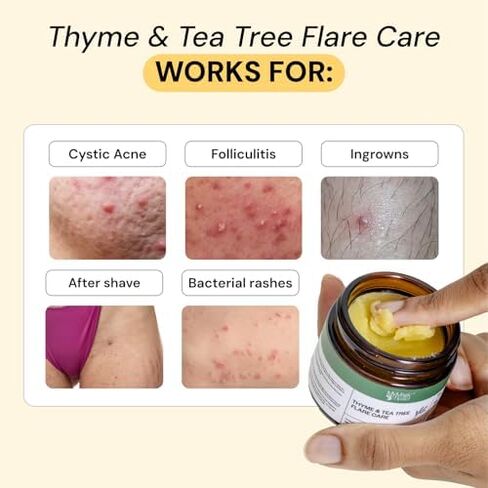 ثنائي العناية الكاملة بالتوهج من MyMagicHealer - مرهم عالمي وشجرة الشاي بالزعتر لعلاج التهاب الغدد العرقية المقيّح والدمامل والطفح الجلدي | العناية المزدوجة للبشرة المتهيجة | مكونات طبيعية (2 × 1 أونصة) in Kuwait