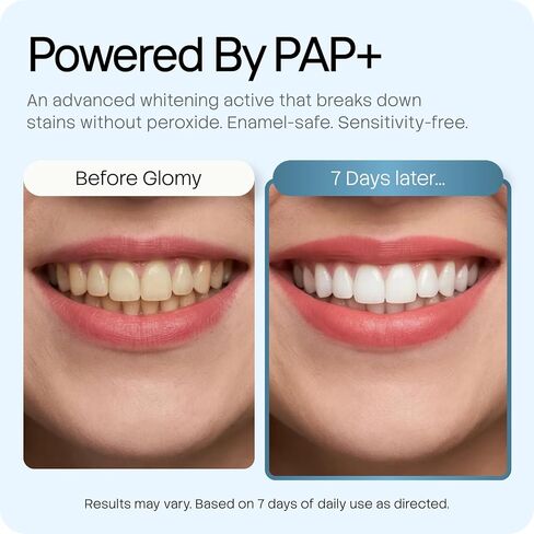 مسحوق تبييض الأسنان مع PAP+ وهيدروكسيباتيت - يزيل بقع القهوة والنبيذ والشاي والتبغ - تبييض خالي من الألم للأسنان الحساسة - آمن على المينا، خالي من البيروكسيد، نباتي - 1.05 أونصة (30 جم) in Kuwait