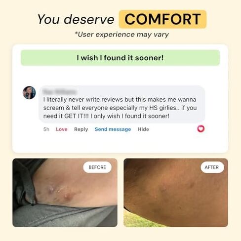 روتين MyMagicHealer HS Flare Care المكون من 3 خطوات - العناية اليومية بالتهاب الغدد العرقية القيحي والبشرة المتهيجة | مرهم الرسم للدمامل والخراجات | المكونات الطبيعية in Saudi Arabia