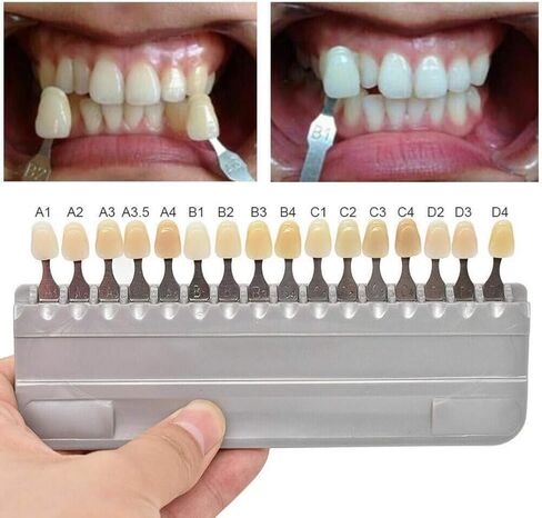 3D-Master 16 Colors Teeth Whitening Shade Guide, Replacement for Vita Classical Tooth Bleaching Shade Mold, Dental Color Comparison Tool for Oral Care Tracking in Kuwait