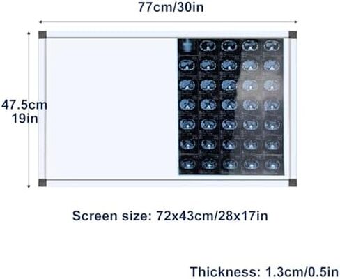 صندوق إضاءة فيلم عارض الأشعة السينية LED المحمول، سطوع قابل للتعديل 0-100%، قابل للتركيب على الحائط، خالي من الظل، شاشة كبيرة (77 × 47.5 سم / 30 × 19 بوصة) للاستخدام في المختبر in Kuwait