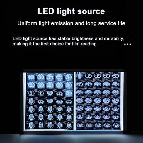 صندوق إضاءة فيلم عارض الأشعة السينية LED المحمول، سطوع قابل للتعديل 0-100%، قابل للتركيب على الحائط، خالي من الظل، شاشة كبيرة (77 × 47.5 سم / 30 × 19 بوصة) للاستخدام في المختبر in Kuwait