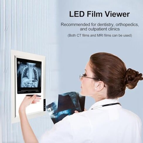 صندوق إضاءة فيلم عارض الأشعة السينية LED المحمول، سطوع قابل للتعديل 0-100%، قابل للتركيب على الحائط، خالي من الظل، شاشة كبيرة (77 × 47.5 سم / 30 × 19 بوصة) للاستخدام في المختبر in Kuwait