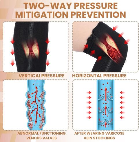Twistover 4 أزواج النساء المفتوحة تو الفخذ عالية زيبر جوارب ضغط 15-20 Mmhg النايلون جوارب طويلة إلى الركب لتورم وذمة in Kuwait