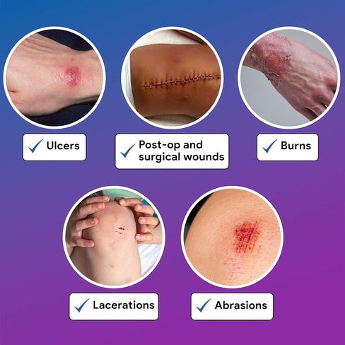 Blue Foam Dressings, 4"x4" - 10 Absorbent Foam Dressings with Antimicrobial Ingredients - Good for Moderate to Heavy Exudate Wounds - Works for Ulcers, Burns, Post-Op, Lacerations, Abrasions, and More in Kuwait