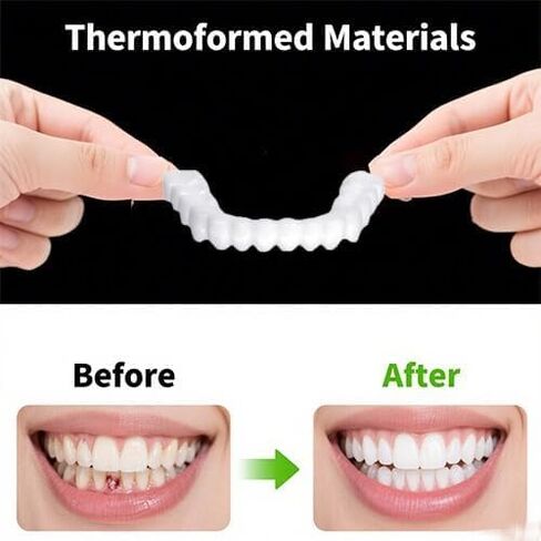 2 Pairs Flexible Smile Enhancement, Adjustable Comfort Fit, Unisex Reusable Daily Set Teeth Whitening Kits (White1) in Kuwait