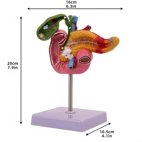 Hepatobiliary Pancreas Model with Gallstones - Gallbladder Surgery Training Kit - Medical School Teaching Aid for Gastroenterology & Digestive System Biology in Saudi Arabia