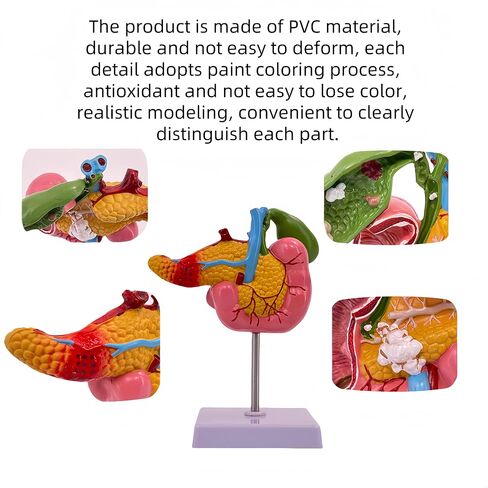 Hepatobiliary Pancreas Model with Gallstones - Gallbladder Surgery Training Kit - Medical School Teaching Aid for Gastroenterology & Digestive System Biology in Saudi Arabia