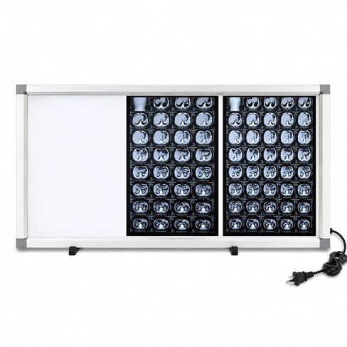 X-Ray LED Film Viewer, Portable Dental Orthopaedic Illuminator with Adjustable Brightness, Flicker-Free, Acrylic Panel Aluminum Frame, Clinic Hospital Lab(Small) in Kuwait
