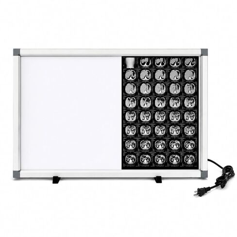 X-Ray LED Film Viewer, Portable Dental Orthopaedic Illuminator with Adjustable Brightness, Flicker-Free, Acrylic Panel Aluminum Frame, Clinic Hospital Lab(Small) in Kuwait
