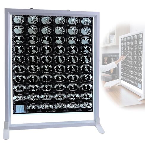 X-ray Film Illuminator Light Box, CT-Film Lab Equipment, X-Ray Viewer Light Panel for Hospital, with knob Control, Wall Mountable & Desktop Stand(16X20in/41X50cm) in Kuwait