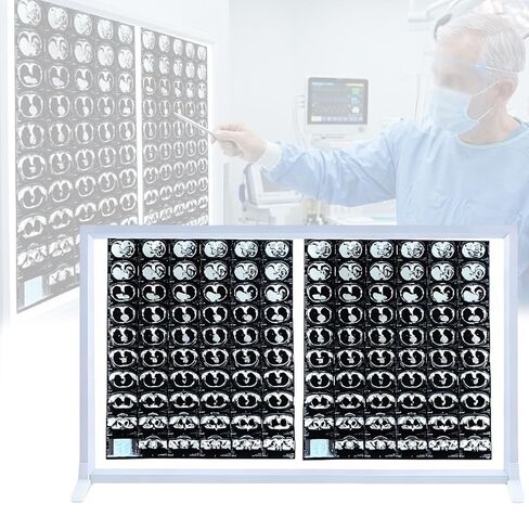 صندوق عرض فيلم LED X Ray، مصباح رقيق للجسم مقاس 1.8 سم، منظار سلبي للسطوع قابل للضبط، مثبت على الحائط أو استخدام سطح المكتب، للأسنان، جراحة العظام، التصوير المقطعي المحوسب، التصوير بالرنين المغناطيسي (30 × 20 بوصة / 77 × 51 سم) in Kuwait