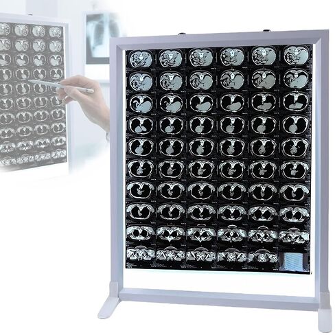 صندوق عرض فيلم LED X Ray، مصباح رقيق للجسم مقاس 1.8 سم، منظار سلبي للسطوع قابل للضبط، مثبت على الحائط أو استخدام سطح المكتب، للأسنان، جراحة العظام، التصوير المقطعي المحوسب، التصوير بالرنين المغناطيسي (30 × 20 بوصة / 77 × 51 سم) in Kuwait