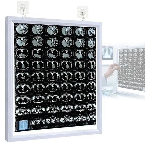 Adjustable LED X-Ray Film Viewer Light Box, Medical Negatoscope, Ultra-Thin 1.8cm, Wall Mountable & Desktop Stand, for Dental, Orthopedic, CT, MRI, Radiology(16X20in/41X50cm) in Kuwait