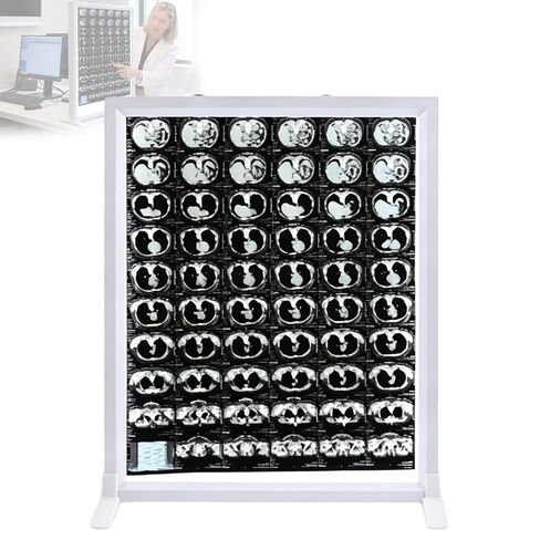 LED X Ray Film Viewer, Medical Radiology Light Box, 1.8cm Ultra Thin Negatoscope, Knob Dimmable, Films Wall Hooks and Desktop for CT MRI Radiographic(16X20in/41X50cm) in Kuwait