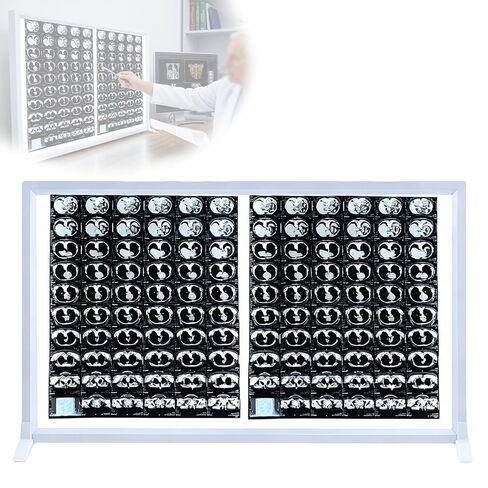 LED X Ray Film Viewer, Medical Radiology Light Box, 1.8cm Ultra Thin Negatoscope, Knob Dimmable, Films Wall Hooks and Desktop for CT MRI Radiographic(16X20in/41X50cm) in Kuwait