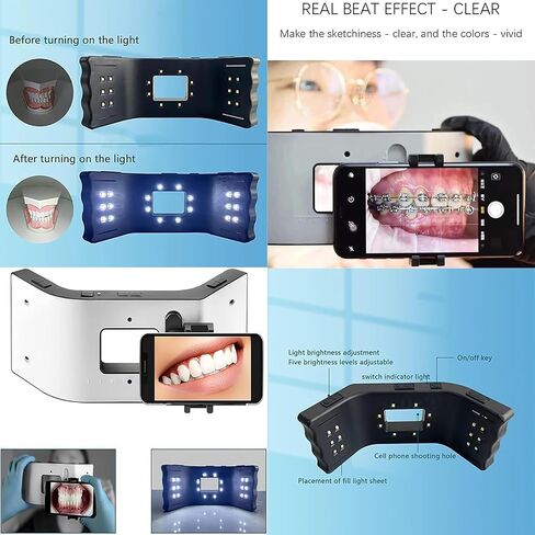 طقم إضاءة التصوير الفوتوغرافي LED للأسنان قابل للتعديل - 5 مستويات سطوع، إضاءة محيطة ثلاثية الأبعاد لتعزيز التصوير عن طريق الفم والمساعدة في الصور in Kuwait