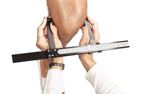 Campbell 10 Small Bone Caliper, Precision Aluminum Tool for Bone Measurements, 180mm Range, 1mm Resolution in Kuwait