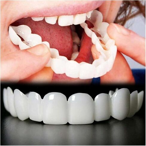 تحسين الابتسامة على البشرة، زوجان من المواد المضادة للحساسية، مجموعة مبيضات أسنان يومية ناعمة ومرنة للجنسين وقابلة لإعادة الاستخدام وقابلة للتعديل (أبيض) in Kuwait