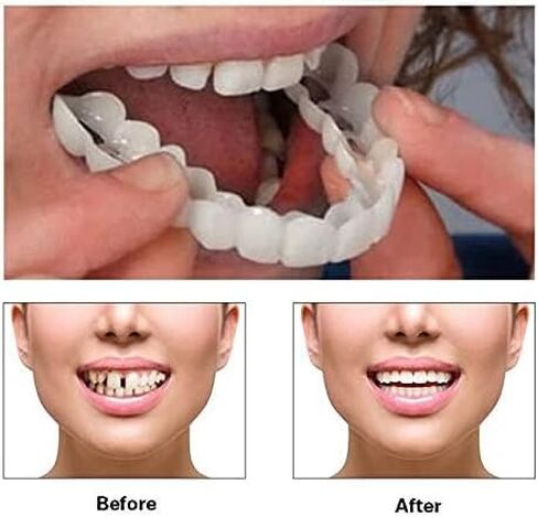 قطعتان، علوية وسفلية، طبيعية ومريحة، الرجال والنساء يستعيدون الثقة في الابتسامة (6) in Kuwait