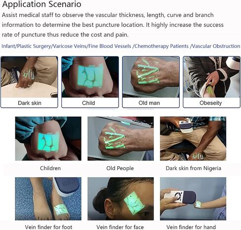 Professional Infrared Vein Finder,Handheld Vein Illuminator Devicew/7 Colors,Puncture Imaging Vessel Finder,Vein Illumination Detector for Doctor Nurse Clinics Homes Use in Kuwait