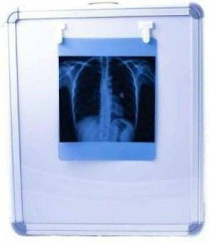 صندوق عرض إضاءة LED X Ray متغير السطوع مزود بتنشيط تلقائي للفيلم in Kuwait