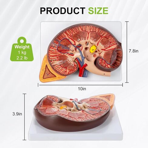 qzzXoq 3X Enlarged Kidney Model - PVC Human Kidney Anatomy Models Biology Demonstration Includes Anatomy of Adrenal Gland and Nephrons for Doctor's Offices, Medical Learning Resources in Kuwait