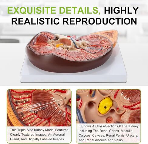 qzzXoq 3X Enlarged Kidney Model - PVC Human Kidney Anatomy Models Biology Demonstration Includes Anatomy of Adrenal Gland and Nephrons for Doctor's Offices, Medical Learning Resources in Kuwait