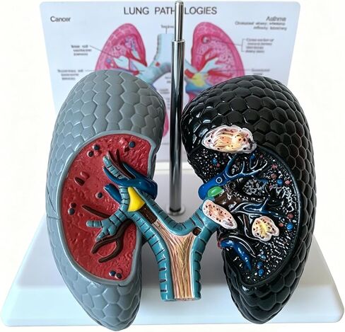 Human Health and Smoking Lung Comparison Model, Healthy VS Smoking Bronchopulmonary Anatomy Display, with English Back Card, for Health Education in Kuwait