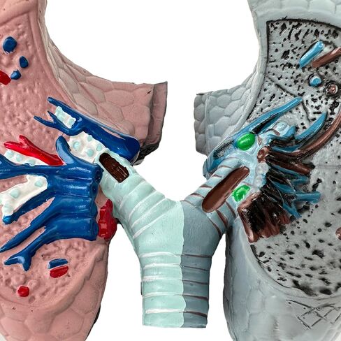 Human Health and Smoking Lung Comparison Model, Healthy VS Smoking Bronchopulmonary Anatomy Display, with English Back Card, for Health Education in Kuwait