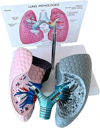 Human Health and Smoking Lung Comparison Model, Healthy VS Smoking Bronchopulmonary Anatomy Display, with English Back Card, for Health Education in Kuwait