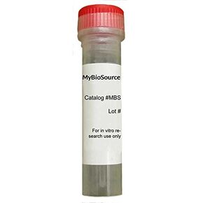 Recombinant Desulfotomaculum reducens 30S ribosomal protein S5 (rpsE) (Recombinant Protein) in Kuwait