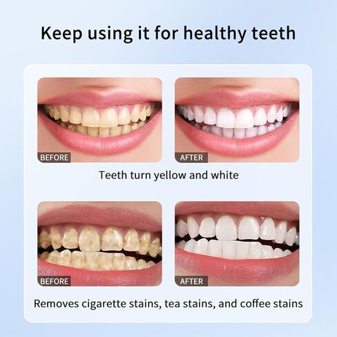 LYDIMOON Teeth Whitening Toothpaste, Appropriate for Sensitive Teeth 4 Oz | Removes Tobacco & Coffee Stains, Freshens Breath, Effectively Whitens Teeth, Suitable For Sensitive Teeth in Kuwait