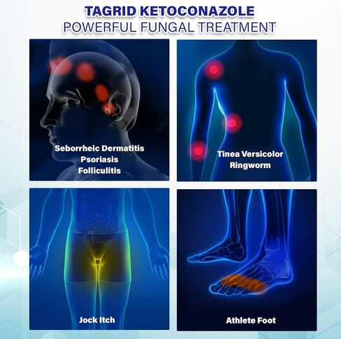 TAGRID Antifungal Cream, Psoriasis, Seborrheic Dermatitis, Ringworm Treatment for Humans, Tinea Versicolor Treatment, Clinically Proven Maximum Relief - 100g in Saudi Arabia