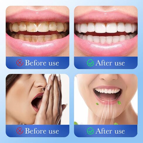Microcrystalline Hydroxyapatite Powder, Microcrystalline Hydroxyapatite, 50g Hydroxyapatites Toothpaste, Stain Removal, Fresh Breath in Kuwait