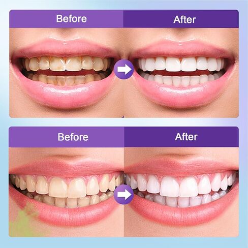Microcrystalline Hydroxyapatite Powder, Microcrystalline Hydroxyapatite, 50g Hydroxyapatites Toothpaste, Stain Removal, Fresh Breath in Kuwait