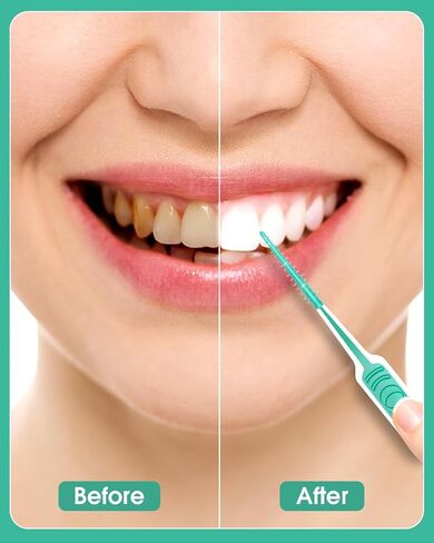 Dental Floss Picks, 200 PCS Soft Silicone interdental Brush, Dental Picks for Teeth Cleaning, Braces Brush, Mint Flavor, Disposable Toothpicks, Suitable for Cleaning Teeth, Green in Kuwait