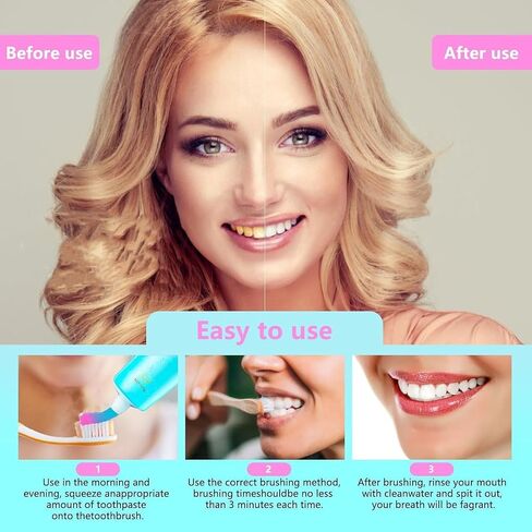 Niacinamide Whitening Toothpaste for Adults, Teeth Whitening Tooth Paste, Brilliant Smile Niacinamide Toothpaste Whiten (3.53oz)- 1 PCS in Kuwait