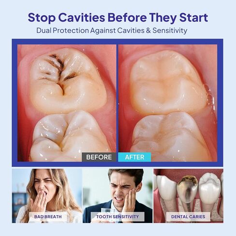 Cavity Healing Tooth Armor Liquid: Clinically Strengthen Enamel with Remineralization Drops at-Home Tooth Enamel Repair Stronger Teeth Hydroxyapatite (120ml, Mint) in Kuwait