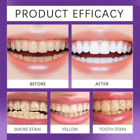 3Pack 7 PRO Toothpaste Whitening, Intense Teeth Whitening Toothpaste for Adults | Fluoride-Free | Sensitivity Safe | Purple Beads | Fresh Breath | Help Remove Tea & Coffee Stains | Mint Flavor in Kuwait